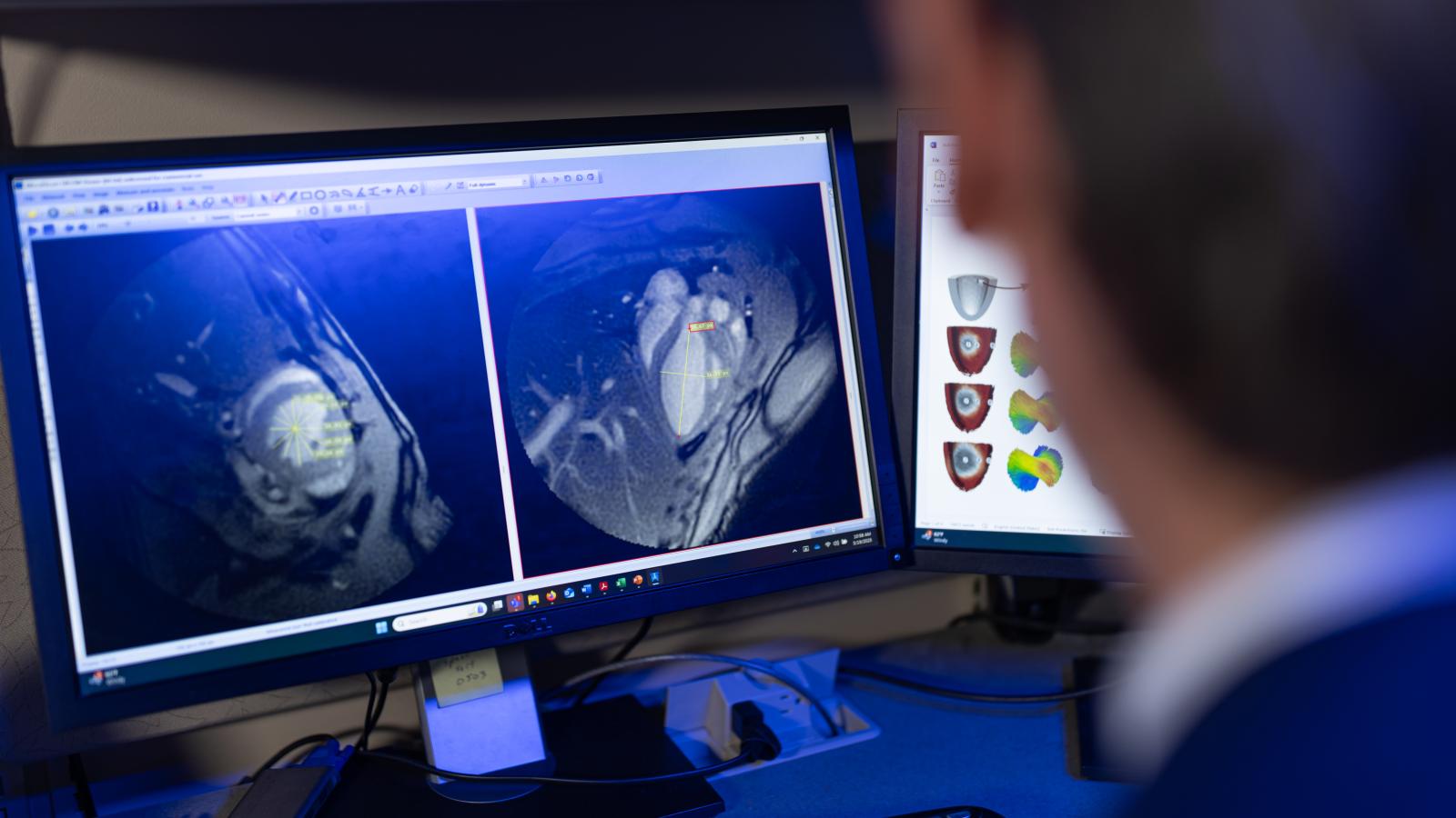 Image of researcher looking at heart on screen